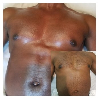 Chest Wax (Men)