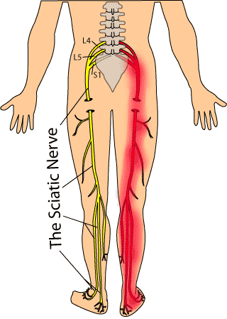 90min Sciatic Nerve PainRelif at Elite Body Massage Sobador in Downey Ca, CA