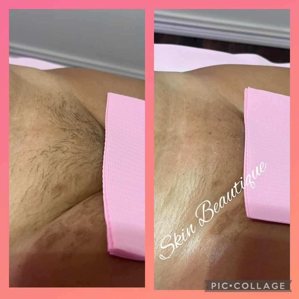 Brazilian Wax