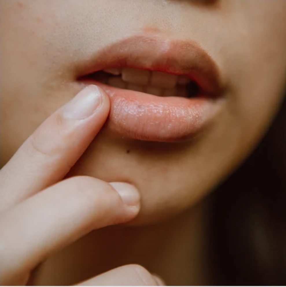 Cleft Lip Camouflage at Mobile Bliss By Shar, LLC in Rochester, NY