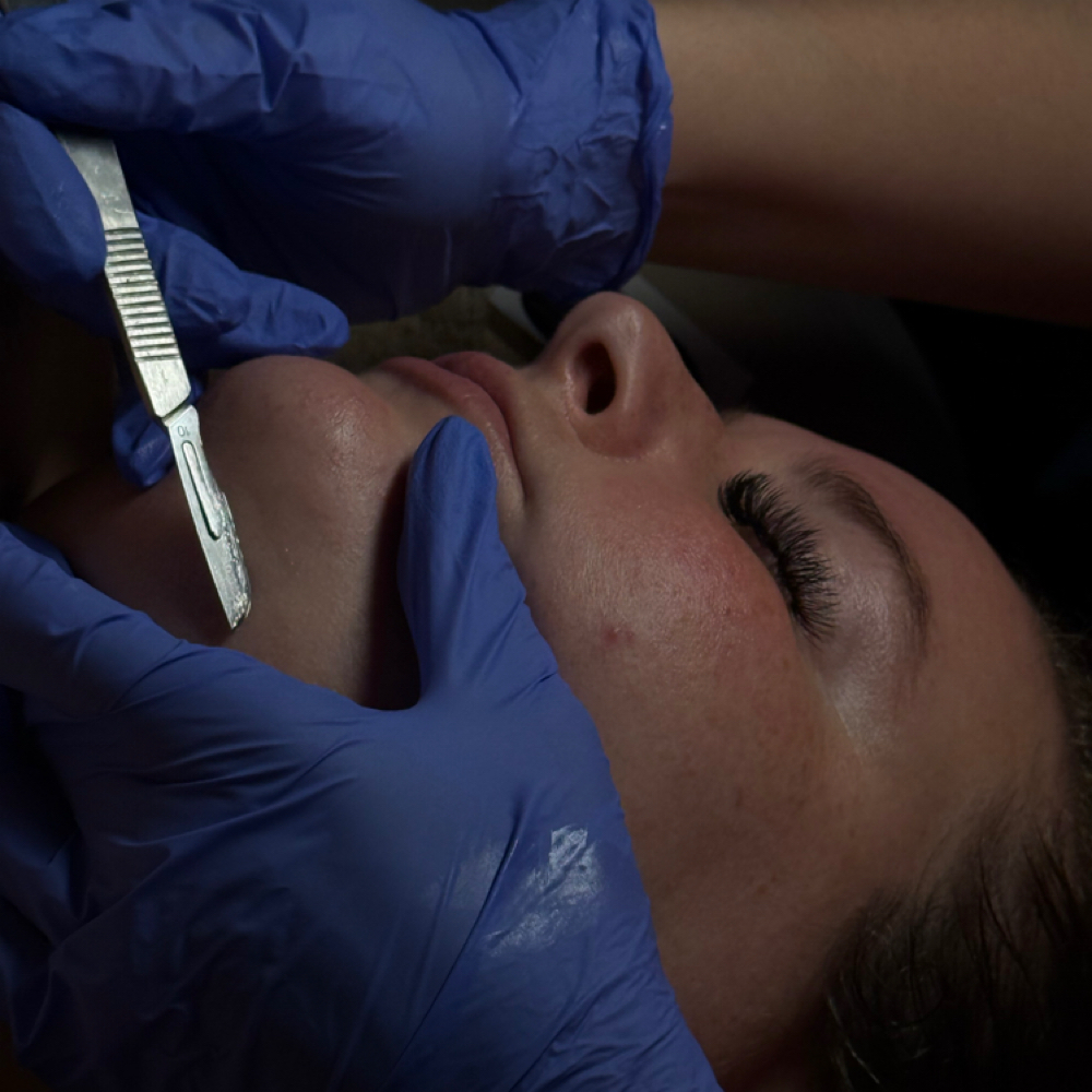 Dermalane Facial at Skin By Jazz LLC in Wisconsin Rapids, WI