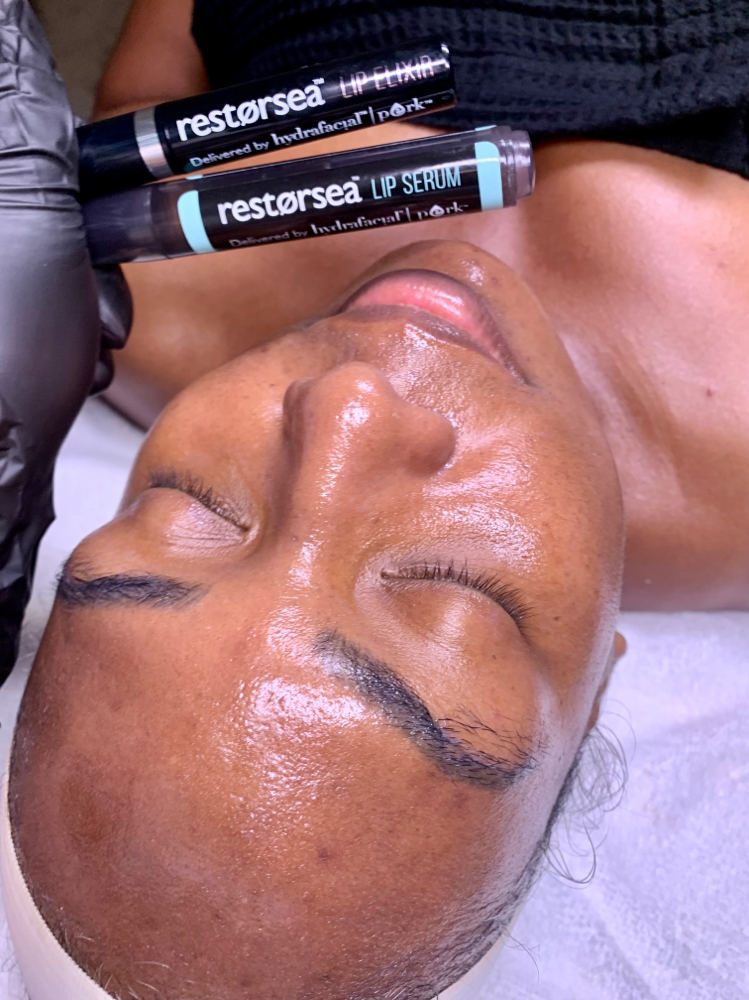 Hydrafacial Lip Treatment