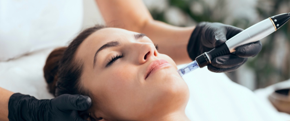 Microneedling