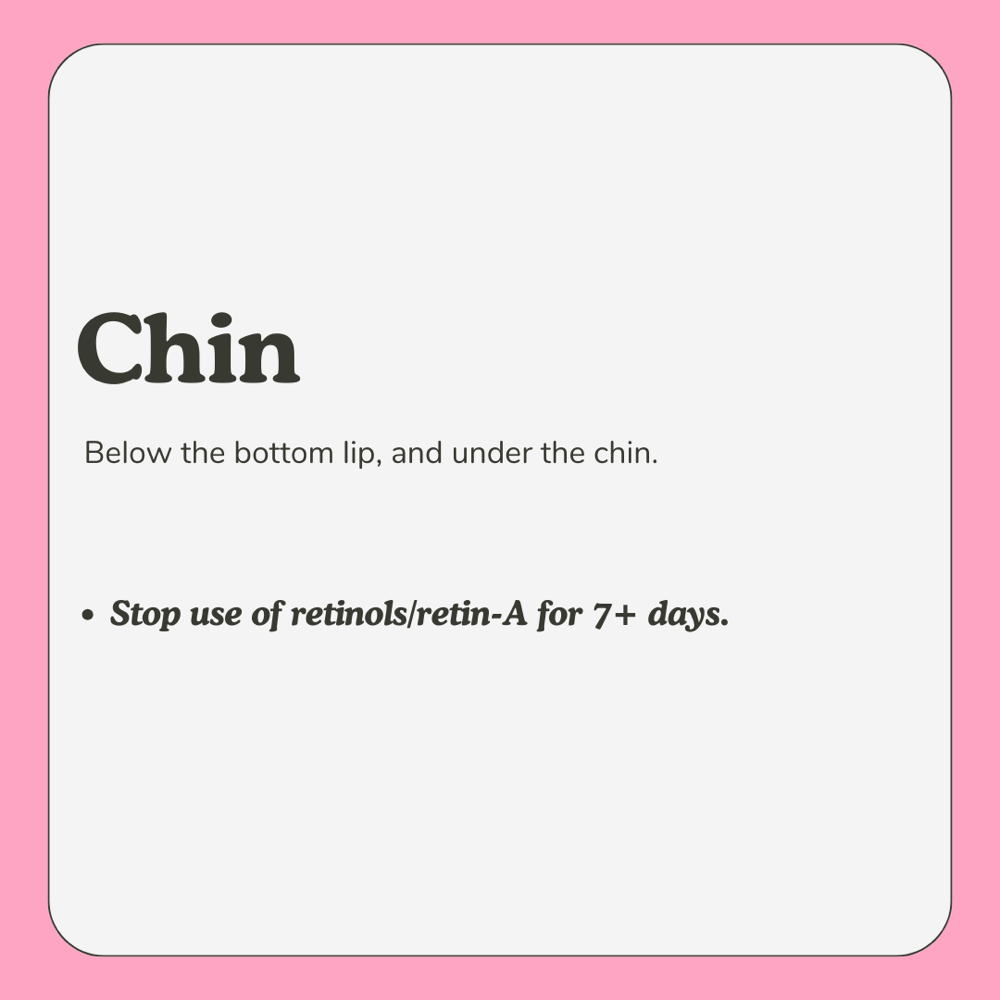 Chin