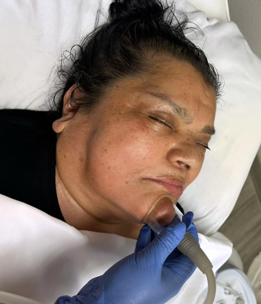 Facial Paralysis Lymphatic Drainage