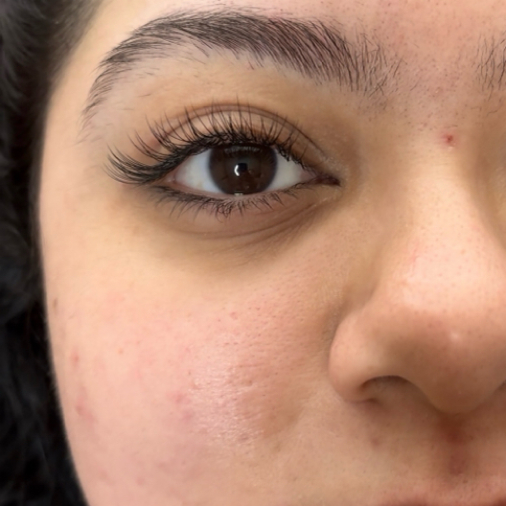 Classic Refill at Lumina Beauty Lab in Houston, TX