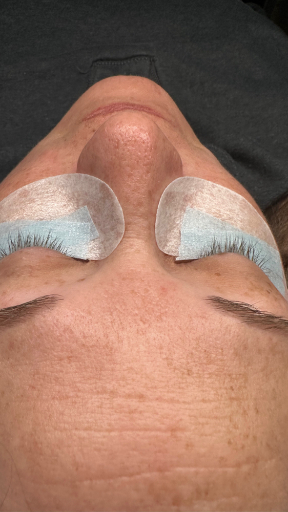 Lash Removal