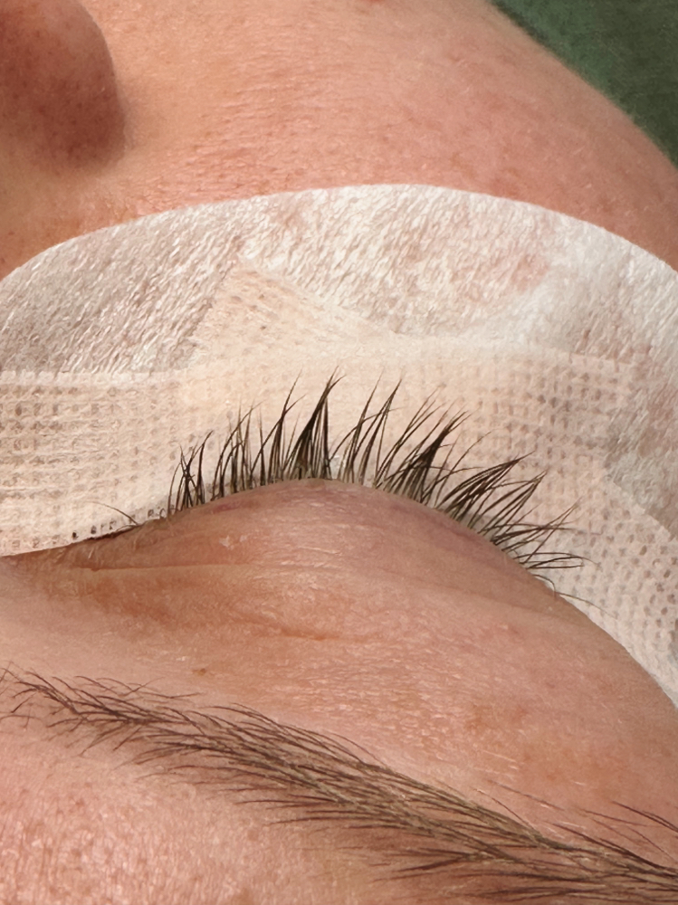 Lash Removal