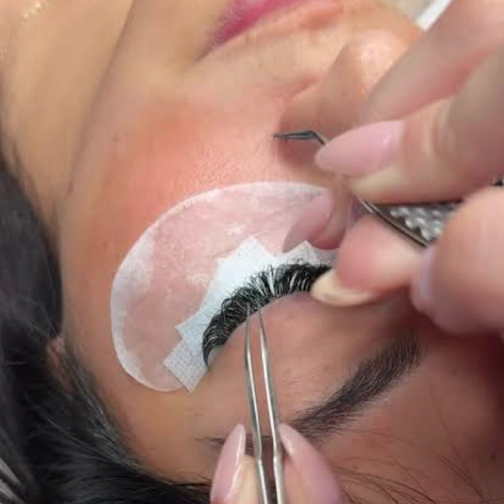Volume Fill (1 Week) at Aura Aesthetics spa in Houston, TX