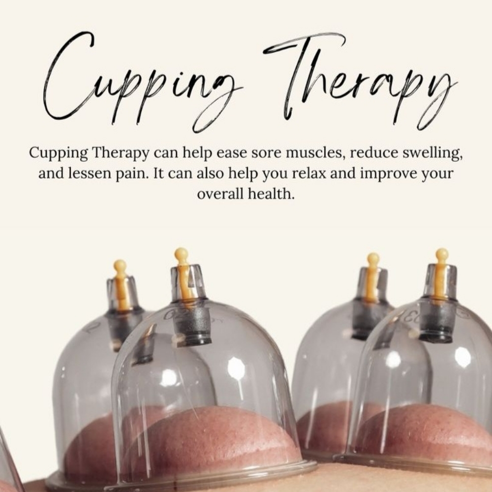 Cupping + Therapeutic at WILD ONE MASSAGE LLC in Elizabethville, PA