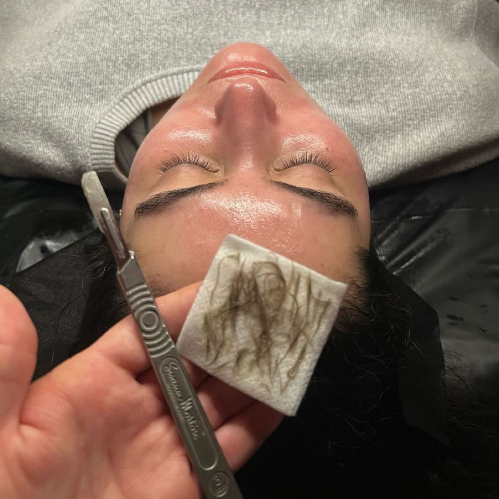 Dermaplane at Skin Church in chicago, IL