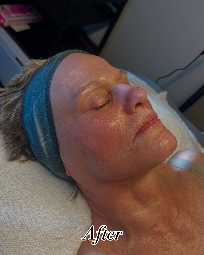 Dew Drop Facial