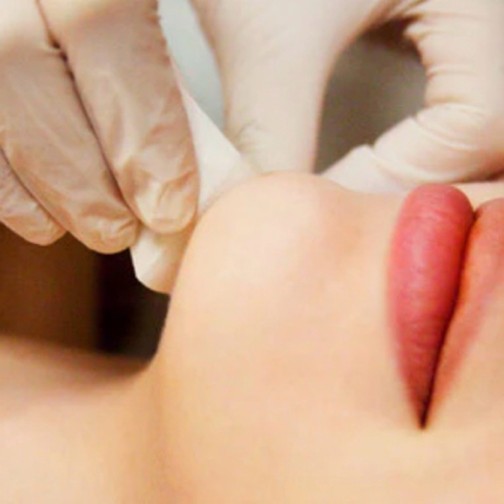 Chin at The Bare Studio Esthetics, LLC in Moline, IL