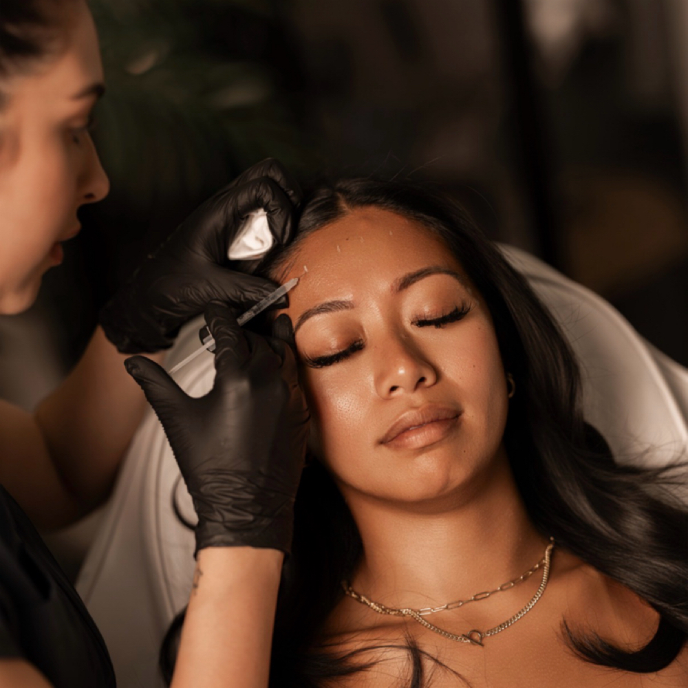 Upper Face Toxin at Fina Aesthetics in Houston, TX
