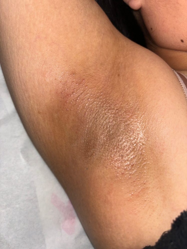 Underarm Wax