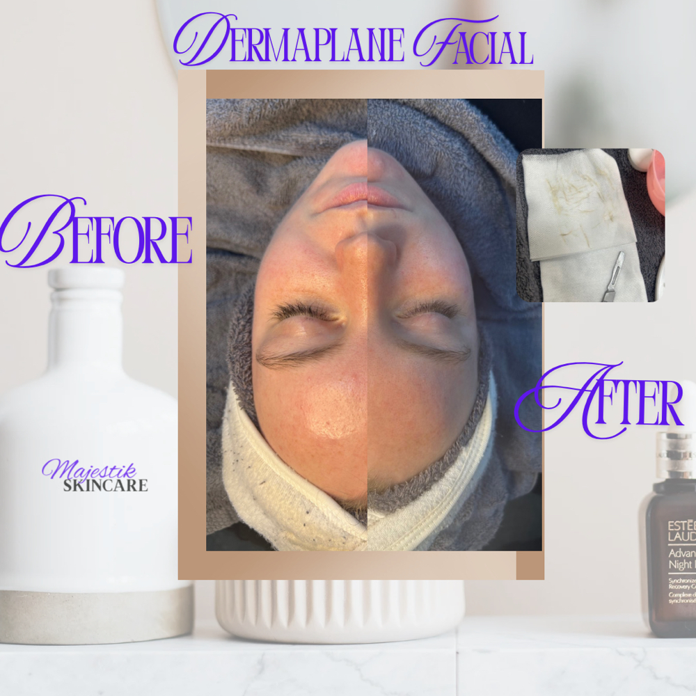Dermaplane Facial at Majestik Skincare in Mobile, AL