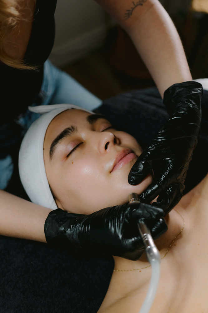 6 Sessions of the Microderm Facial