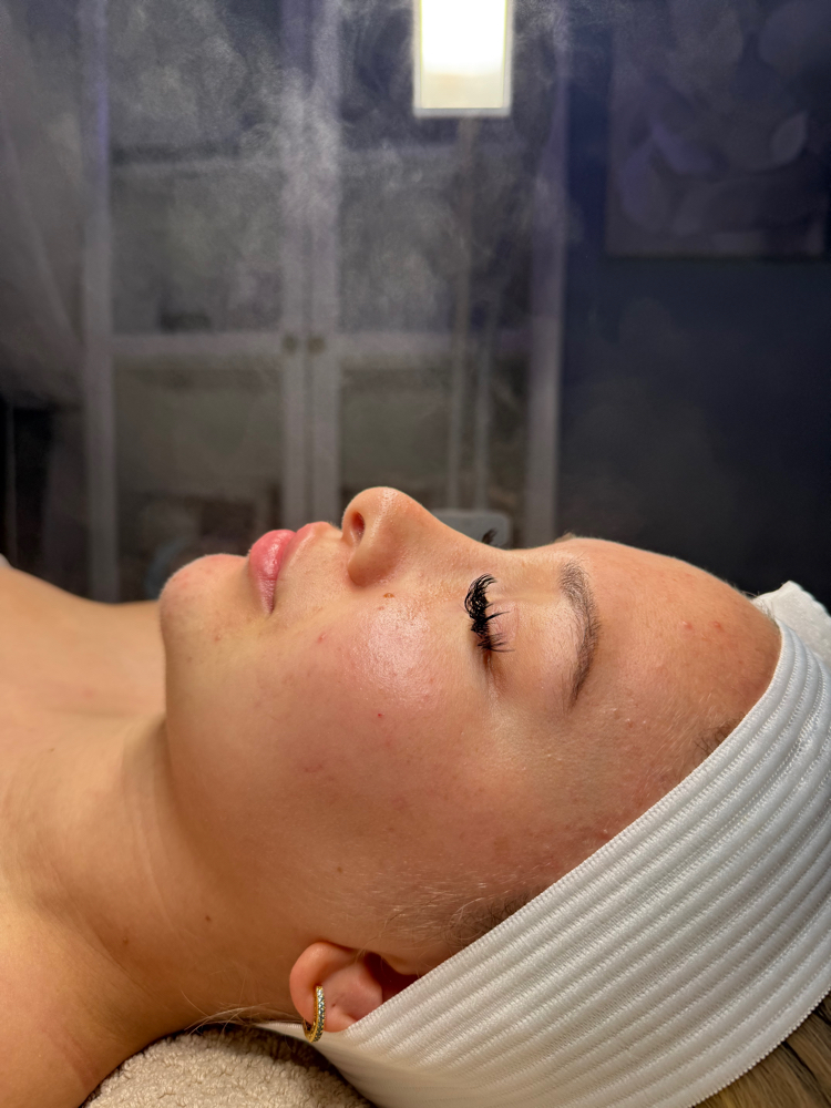 GLOW & GO ACNE FACIAL