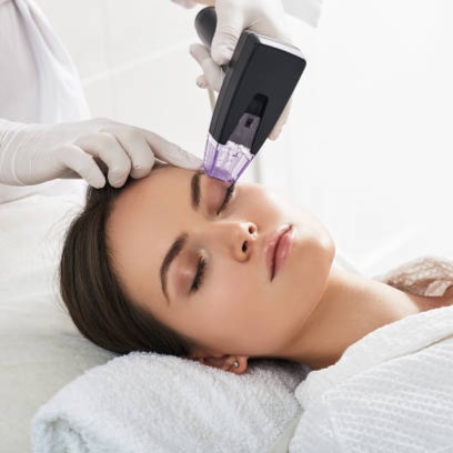 Morpheus8 - Eye Microneedling