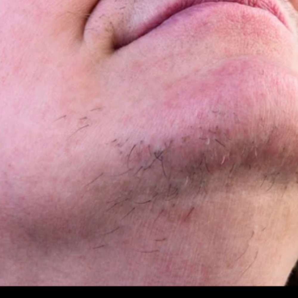 Beyond the Wax Treatment at MP Esthetics: Waxing & Skincare Murrieta in Murrieta, CA