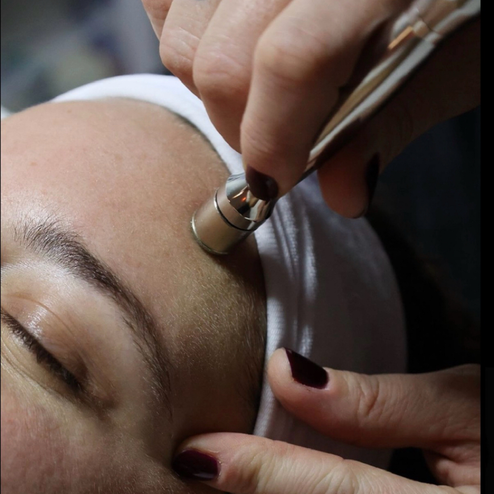 Microdermabrasion at Aesthetics by Makinlee in Pahrump, NV