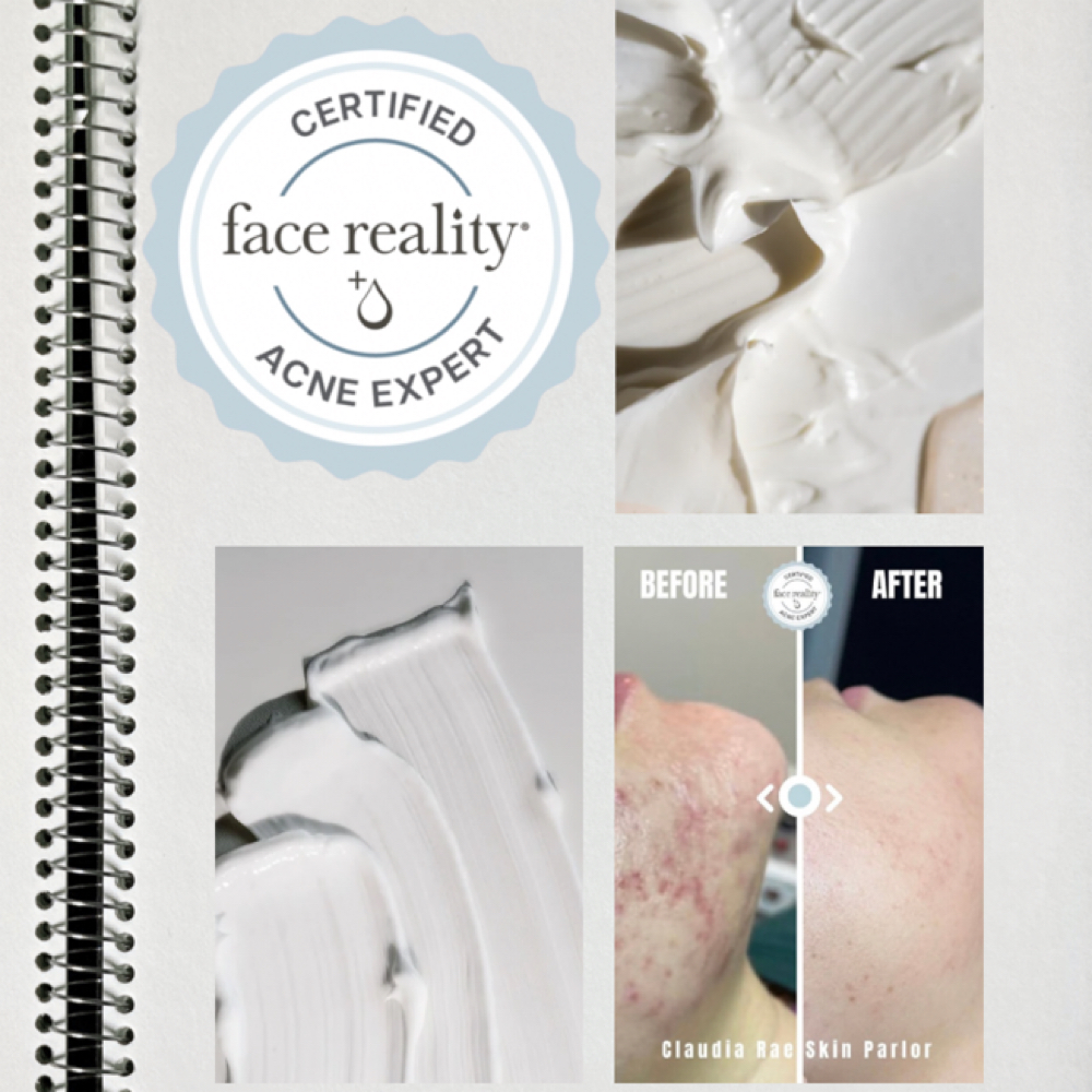 Acne Consultation at Claudia Rae Skin Parlor in Olney, IL