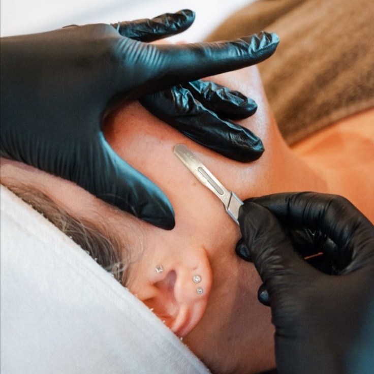 Smooth Silk Dermaplaning at Skin88 Studio in Beverly Hills, CA