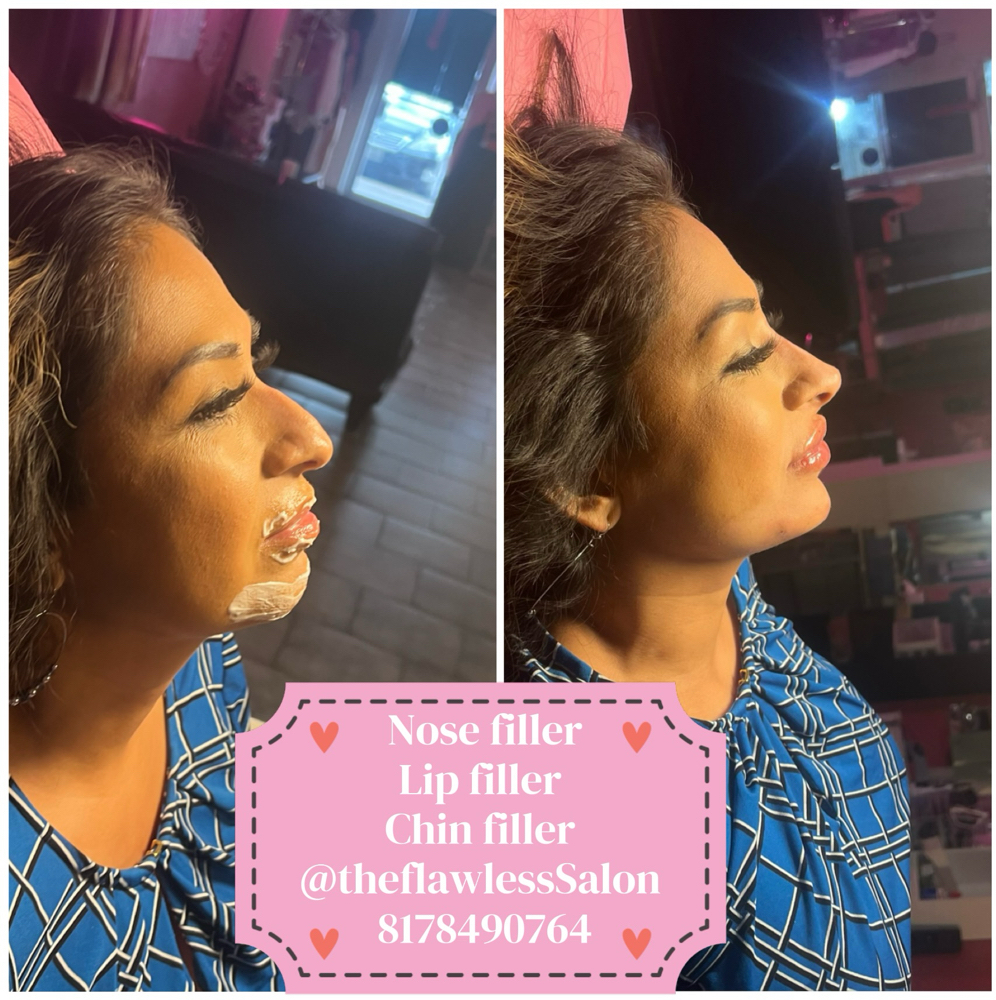 Signature Facial Transformation at Flawless Spa & Beauty in Fort Worth, TX