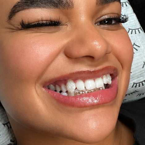 Swarovski Tooth Gem at Julie's Aesthetics in Belleville, NJ