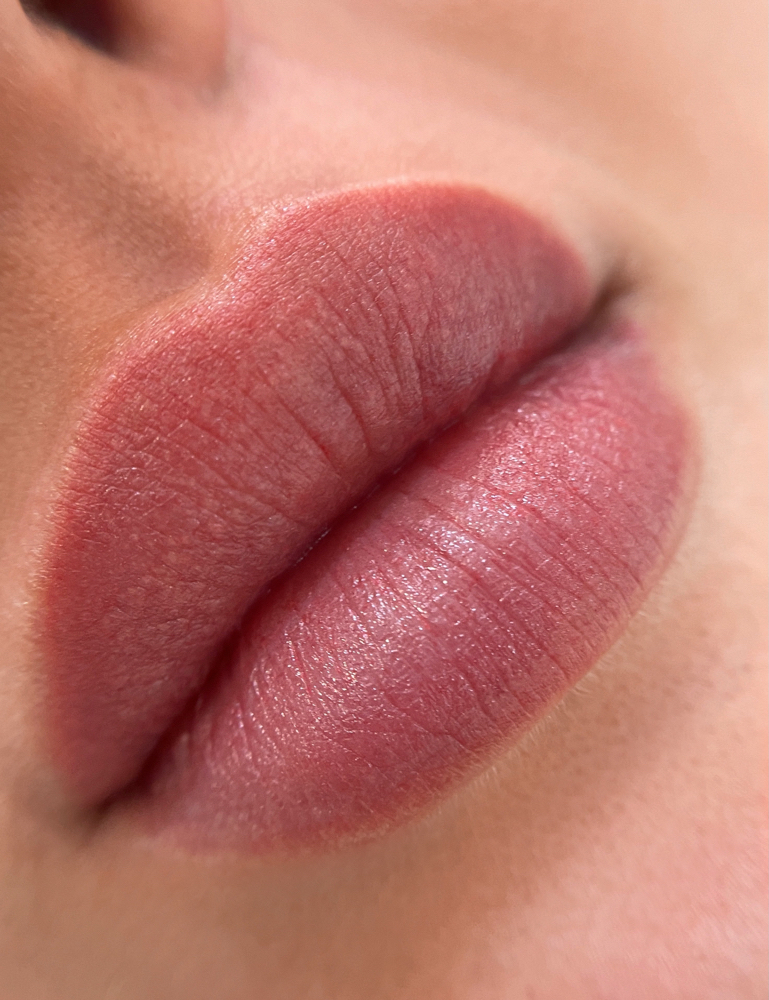 Touch-up Lips (after 1-3 months)