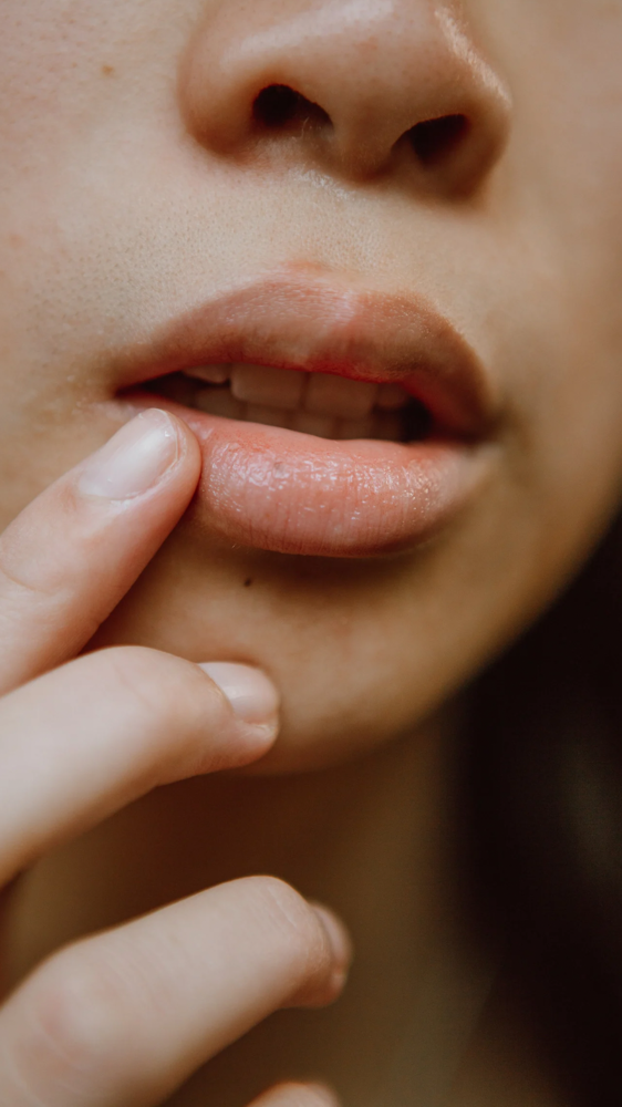 Lip Filler