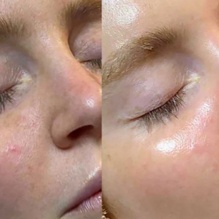 Signature Hydrafacial at Merle Norman of Sharyland Spa and Boutique in Mission, TX