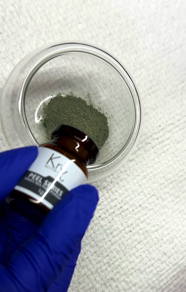Chemical Peel Treatment