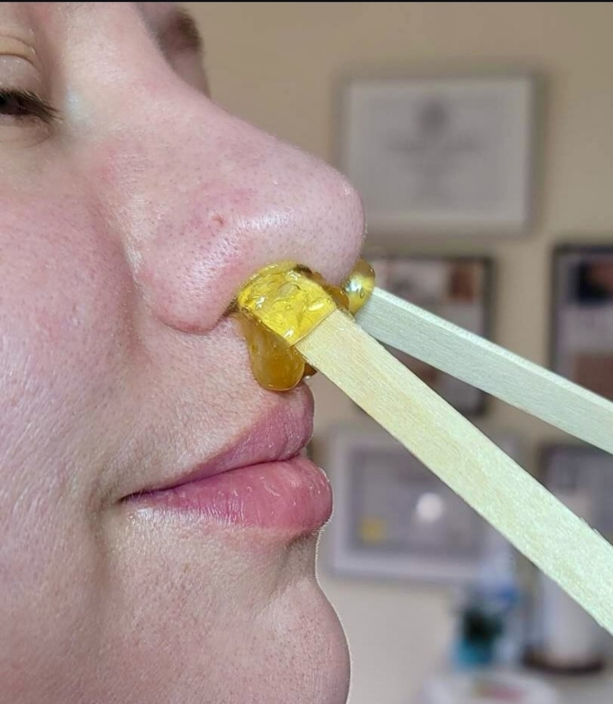 Nose Wax at Haus Of Skin in Burleson, TX