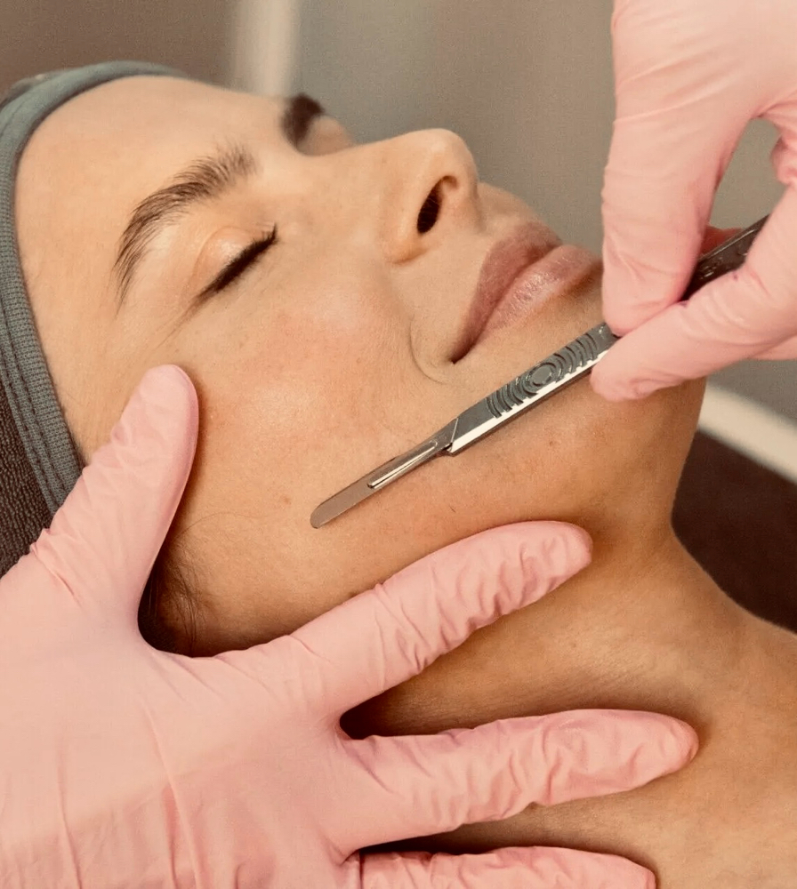 Dermaplaning