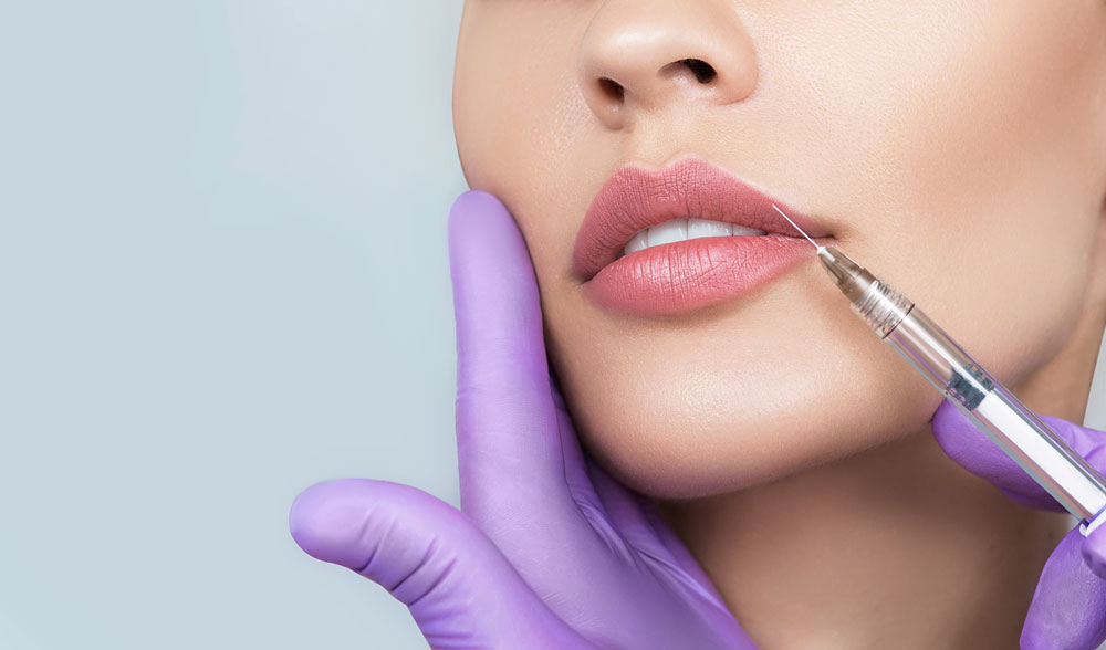 Hyaluronic Acid Lip Fillers