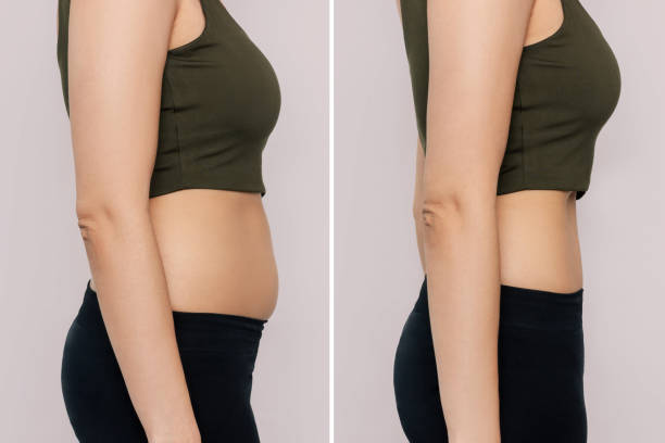 Weight loss follow up