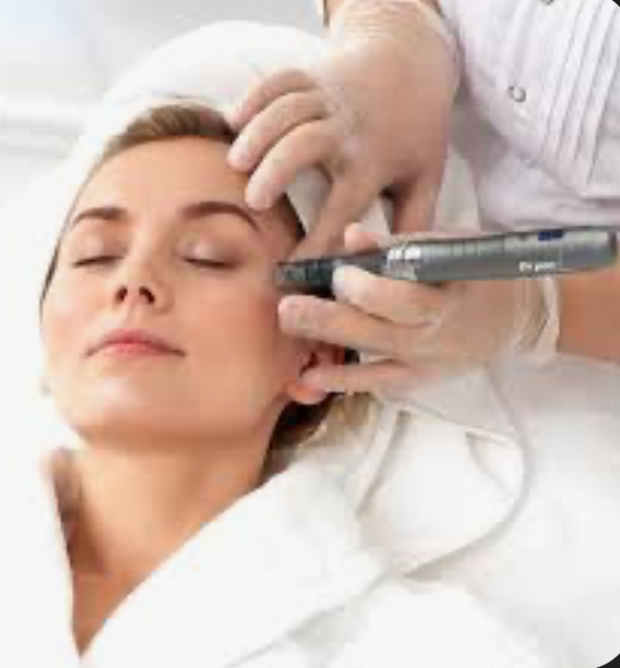 Microneedling (face)