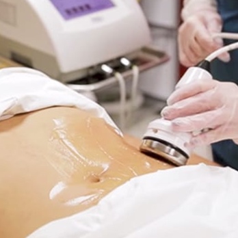 Ultrasound Cavitation (Cavi Lipo)