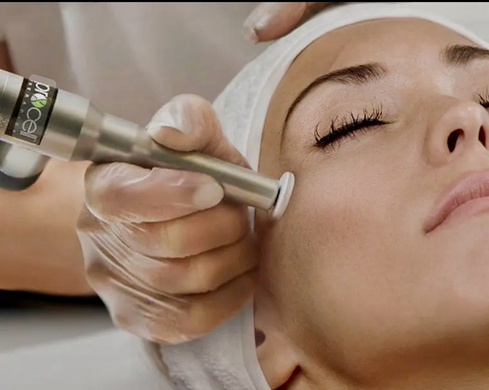 Procell Microchanneling