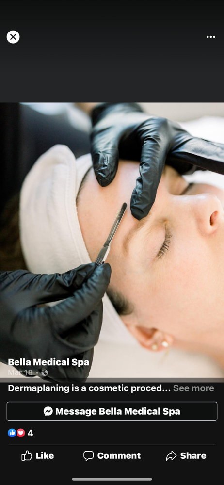 UNWND DERMAPLANE
