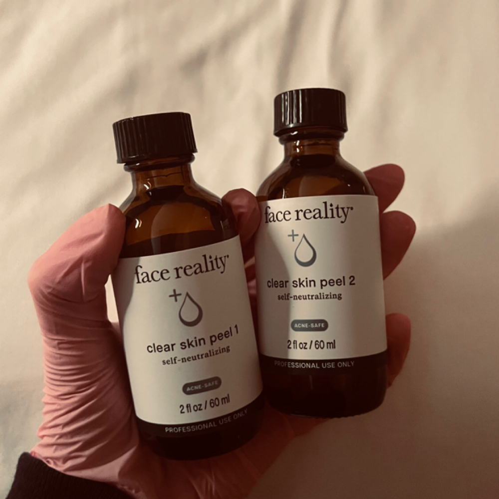 Acne Treatment at Esthetically Courtney in London, KY