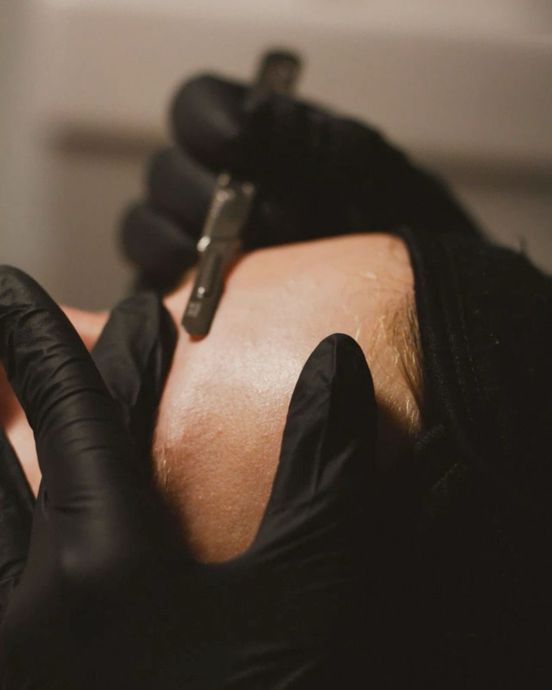 The Dermaplane Facial at True Skin By Lis in Ventura, CA