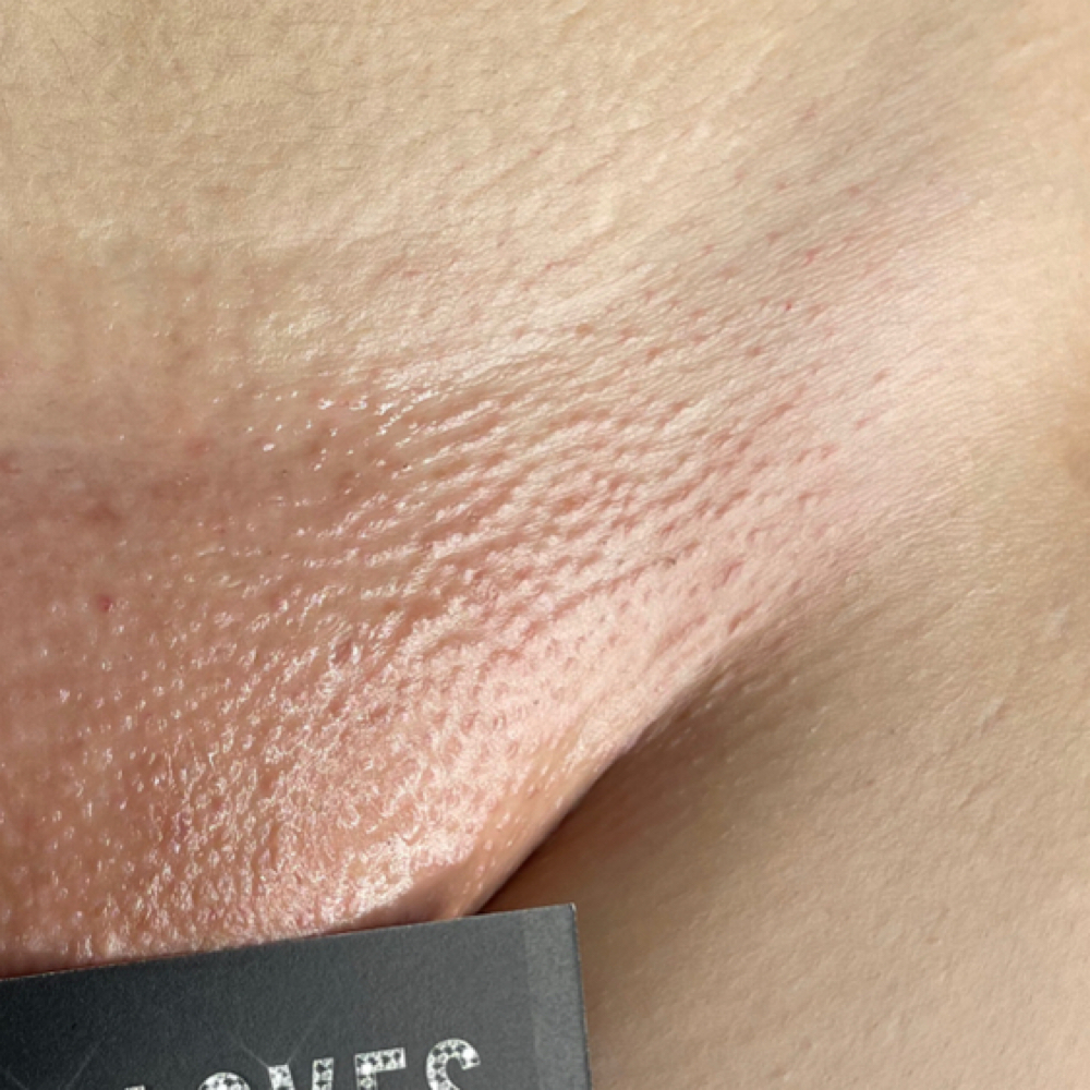 Brazilian & Underarms