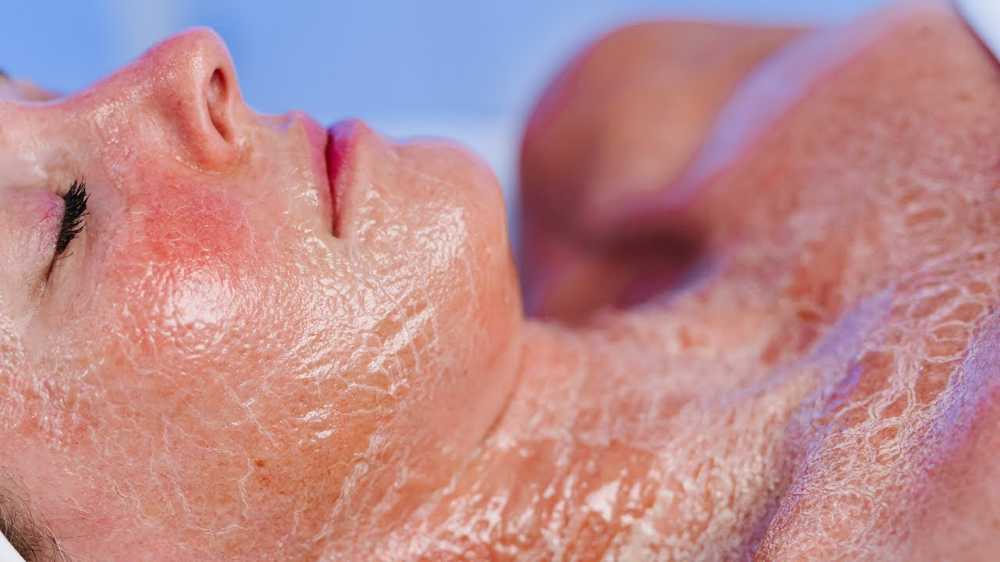 Fauxtox Facial