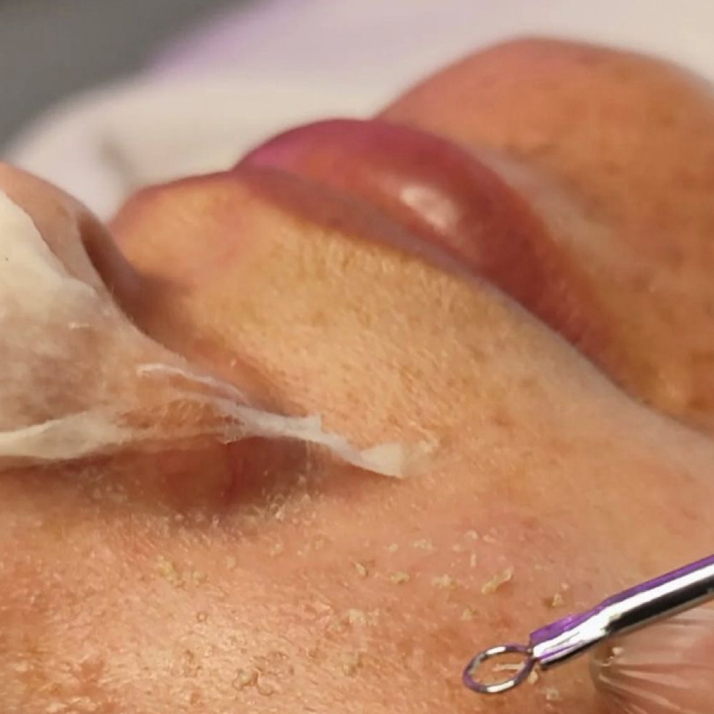 Deep cleansing facial at Aries Beauty & Wellness in Chandler, AZ