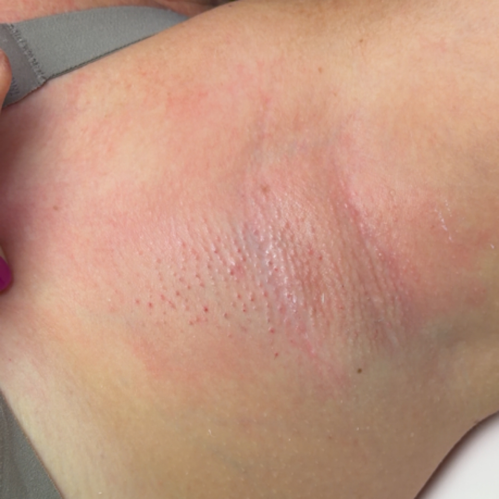 Underarm Wax at The Strip Beauty Studio in Summit, MS