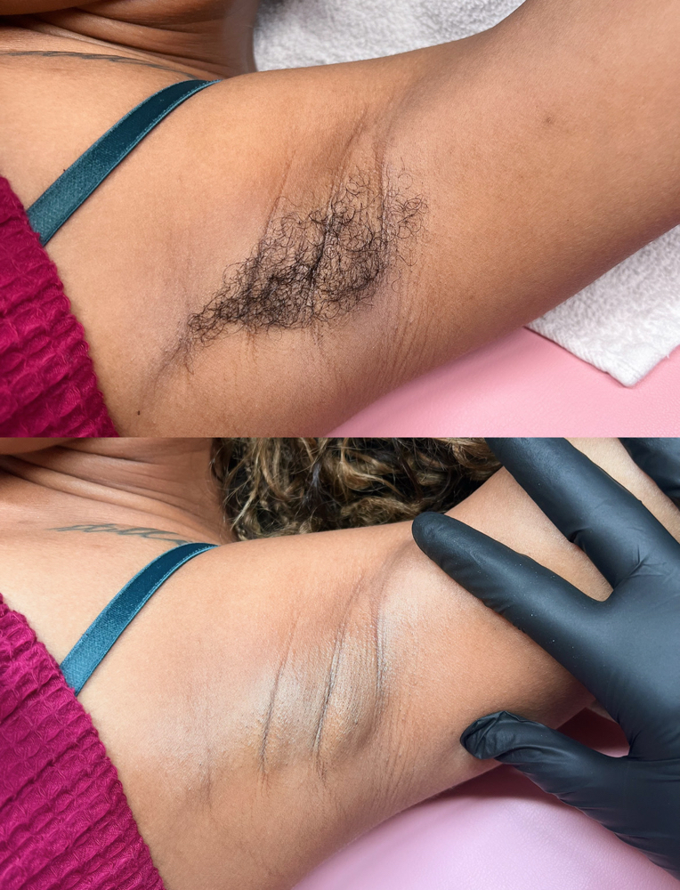 ⋆˙⟡ Underarms ⟡˙⋆