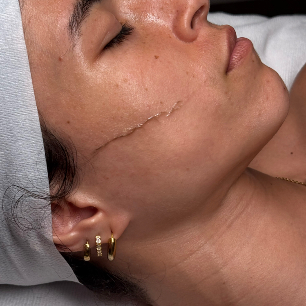 Dermaplaning Luminance Facial ⊹♡ at Elara Skin Bar in Carolina, PR