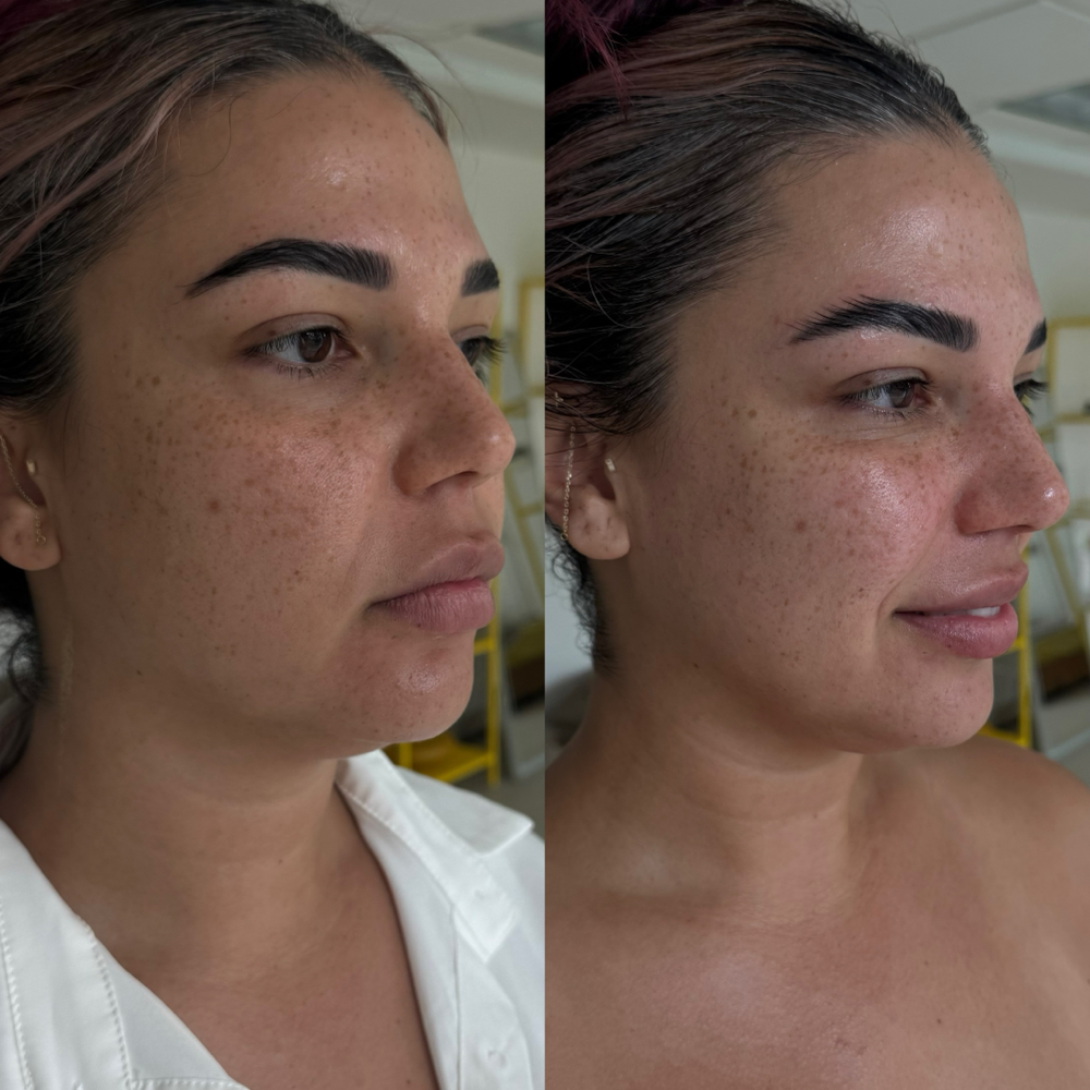 LYMPH FLIGHT For LADIES